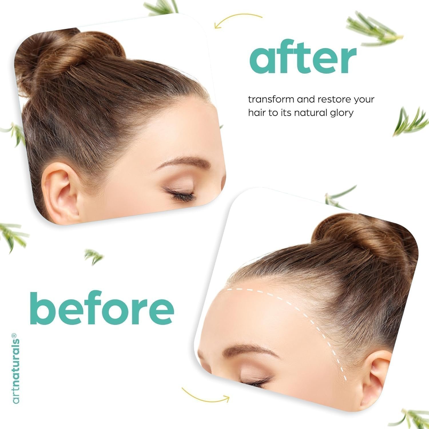 Artnaturals Organic Rosemary Castor Hair Oil + Scalp Massager Hair Growth Set Hair Growth Oil 118ml ounces - Image 2