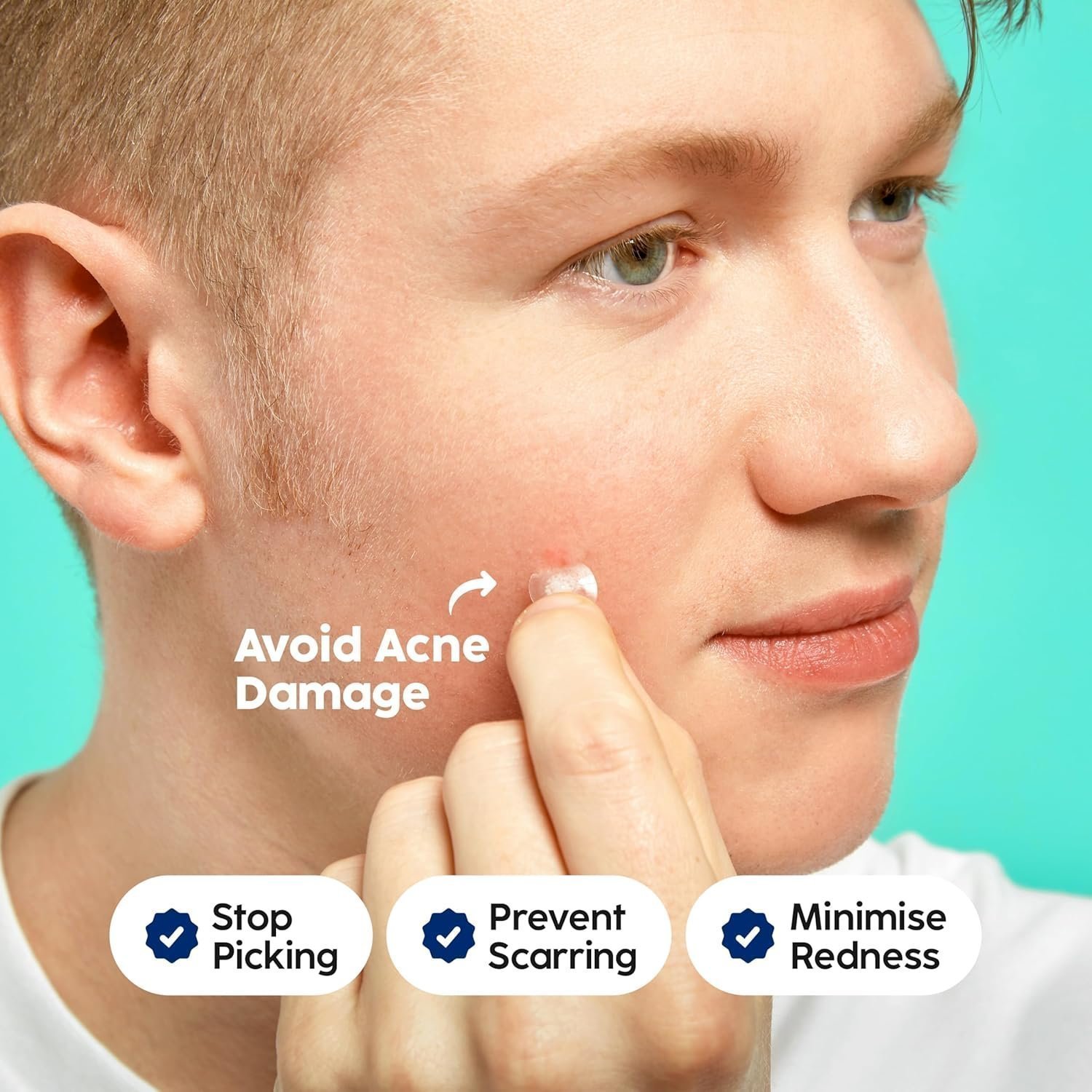 Patch Perfect Spot Patches (102 Count), Vegan & Cruelty-Free Spot Stickers (2 Sizes) - Image 4